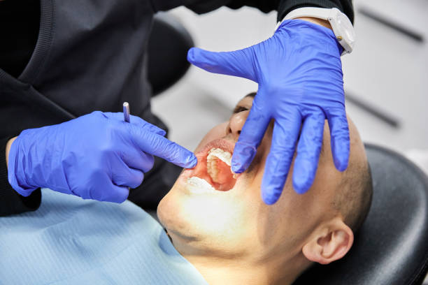 Best Emergency Broken Tooth Repair in Hedwig Village, TX